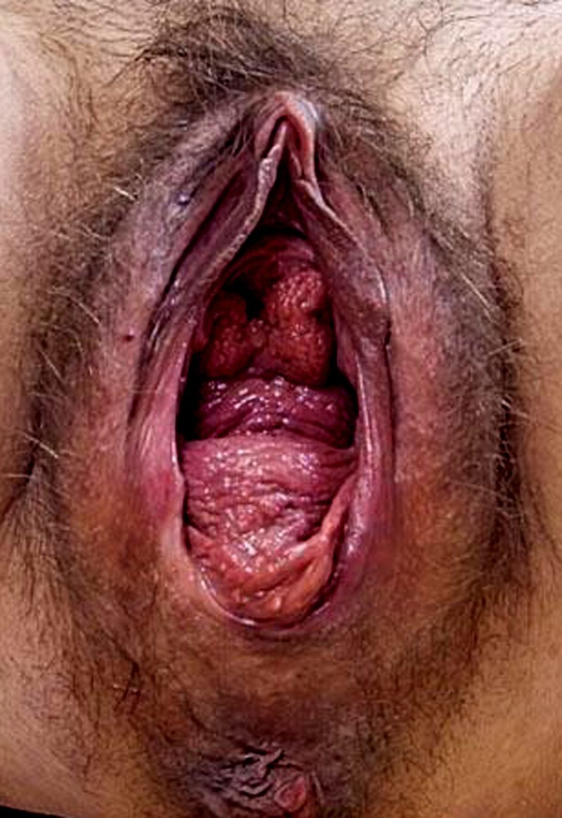Nasty naked women