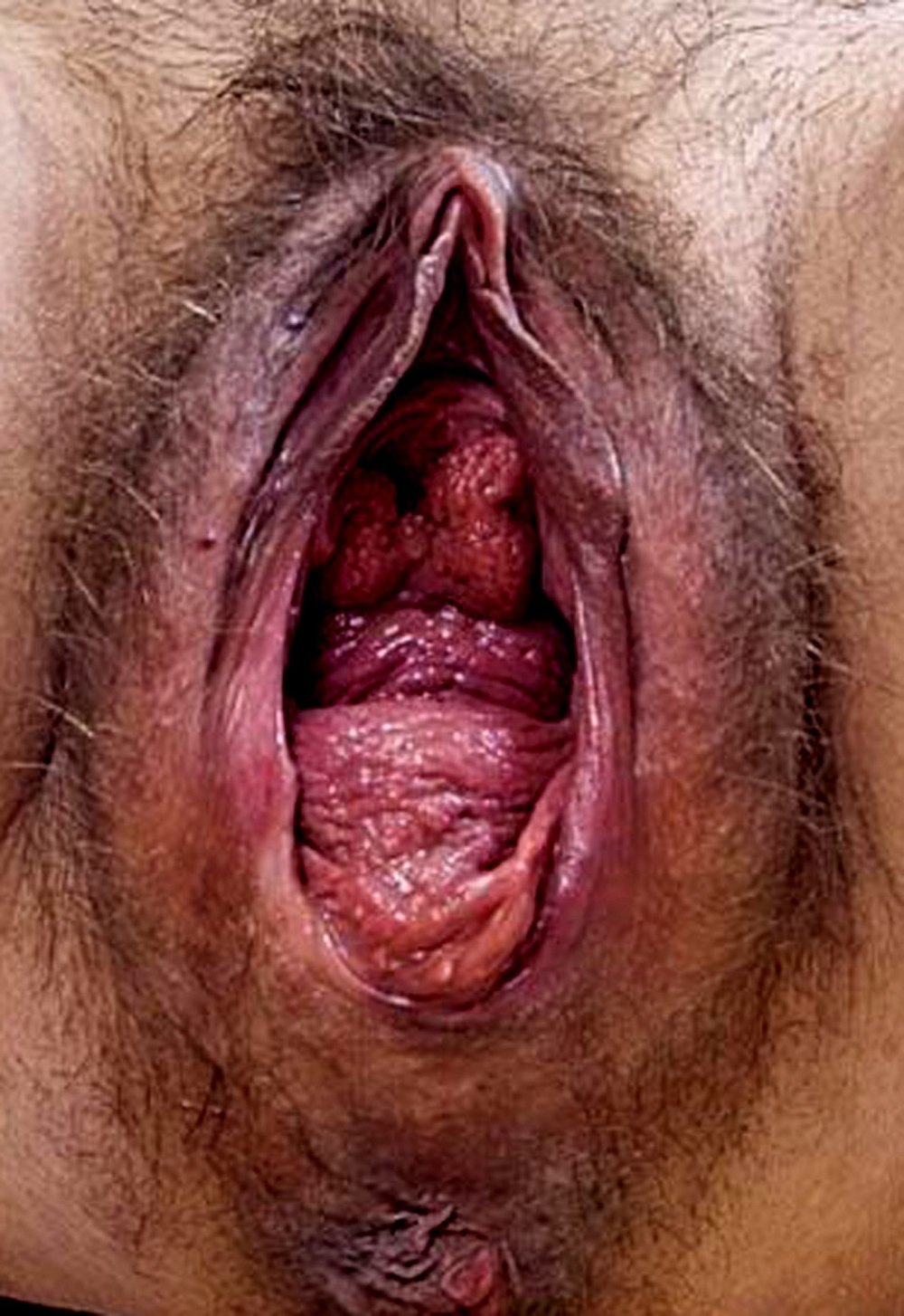 The most dull vagina