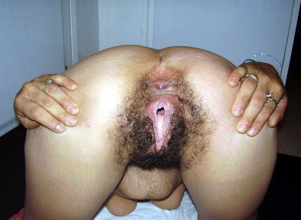 Huge hairy anus
