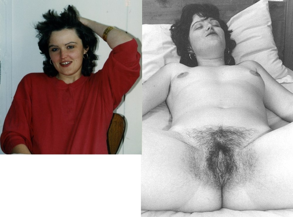 Dressed and striped hairy women
