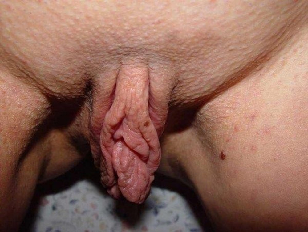 A terrible hairy vagina